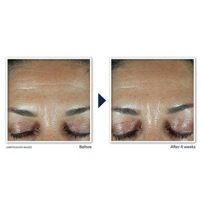 This is Beauty - RoC Retinol Correxion Deep Wrinkle Filler 1 fl oz - Imperfect Box