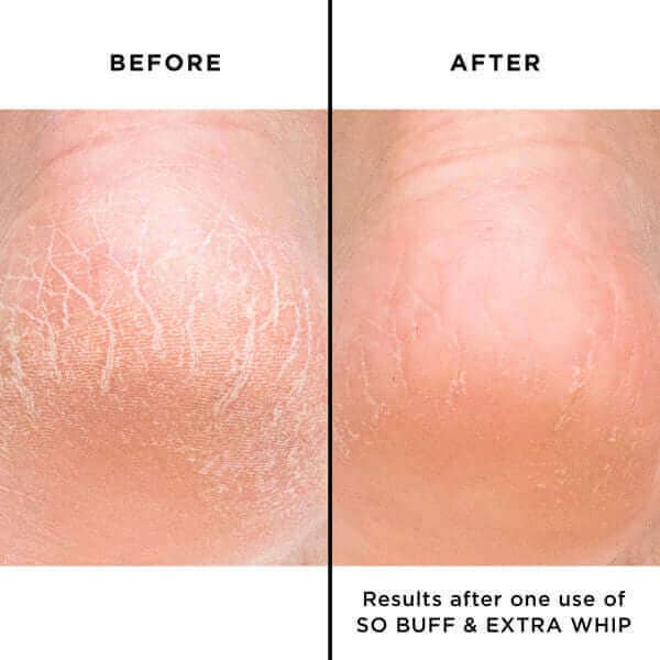 butter LONDON - Extra Whip Deluxe Hand & Foot Treatment - Mini