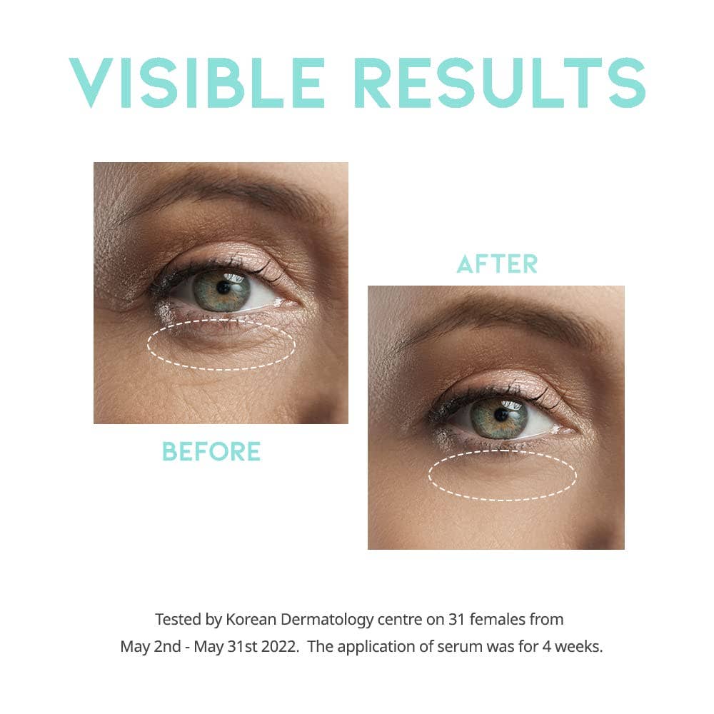 Best Beauty Group - OOTD Wrinkle Lift Eye Serum