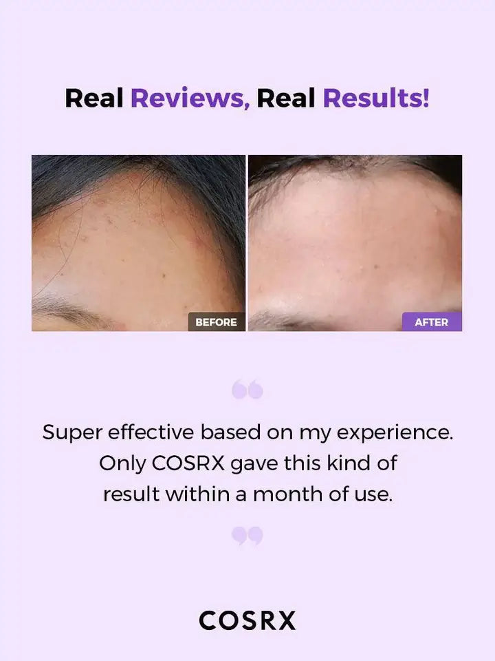 Best Beauty Group - COSRX AHA BHA Clarifying Treatment Toner MINI